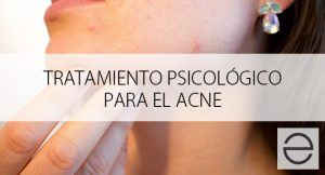 Tratamiento psicológico para el acné